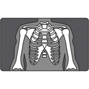 Xray Illustration