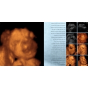 Ashton Pregnancy Book 2004-2005: 3D Ultrasounds